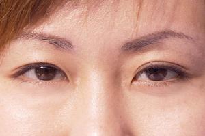 【2026年最新版】海老名で鍼灸を最も効果的に選ぶ方法とおすすめ施術院完全ガイド